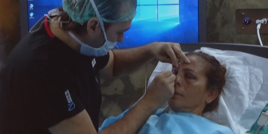 AKRAN ZORBALIĞINA MARUZ KALANLAR 10 KAT DAHA FAZLA ESTETİK YAPTIRIYOR