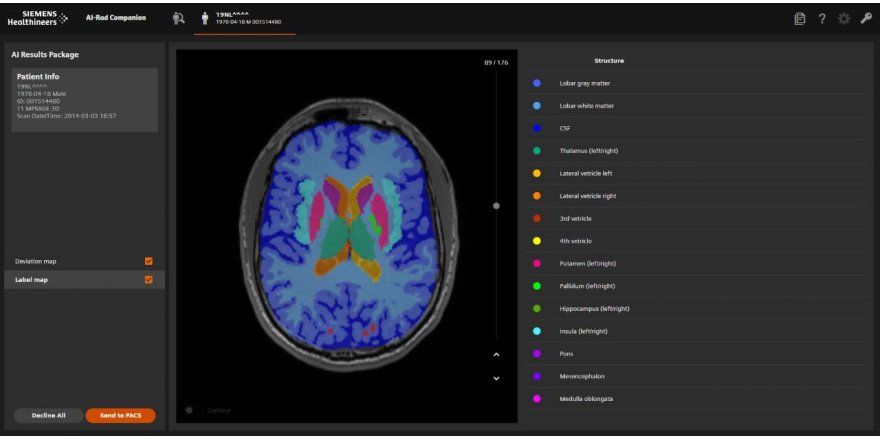 "YAPAY ZEKA MR İLE BİRLEŞİNCE HASTALIK TEŞHİSLERİ KOLAYLAŞTI"
