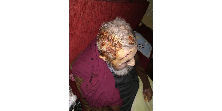 ŞİŞLİ'DE 93 YAŞINDAKİ ADAMI ÖLESİYE DÖVÜP GASP ETTİLER