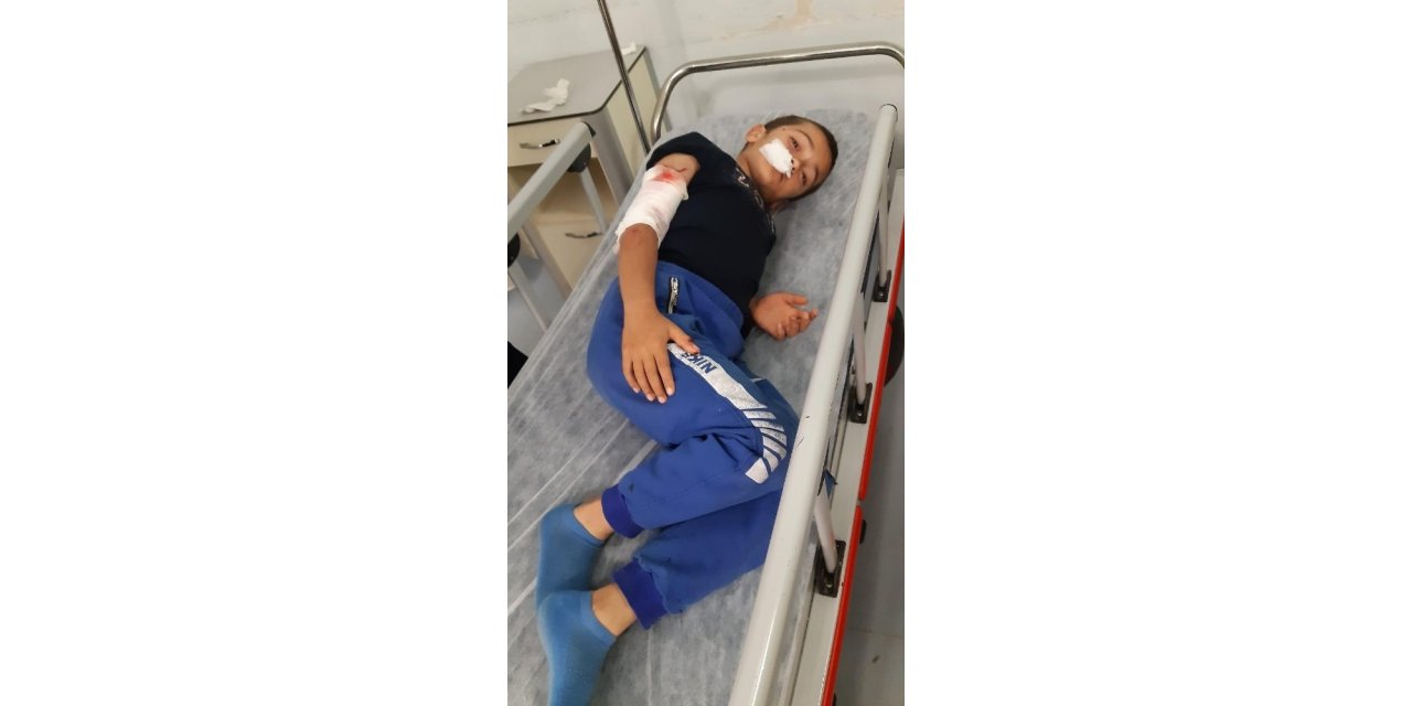 Sultangazi’de 10 Yaşındaki Çocuğa Köpek Saldırdı