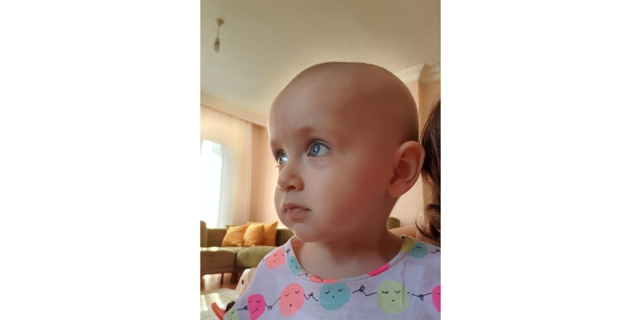 Duru Bebek Sağlığına Kavuşmak İçin Yardım Eli Bekliyor