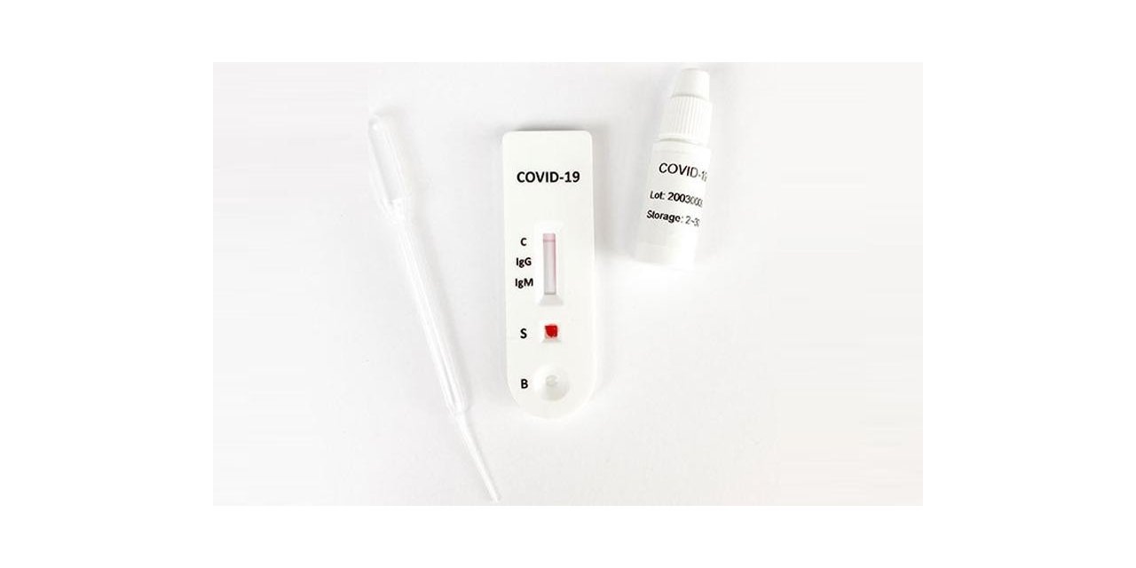 Uzak Doğu’dan İthal Edilen Antikor Test Kitlerindeki Tehlike