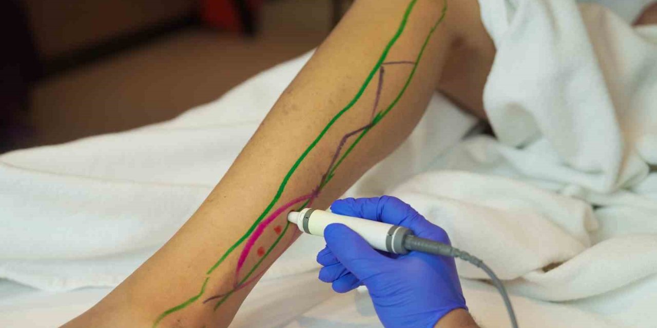 DOKU TRANSFERİYLE YARA ONARIMINDA YENİ DÖNEM