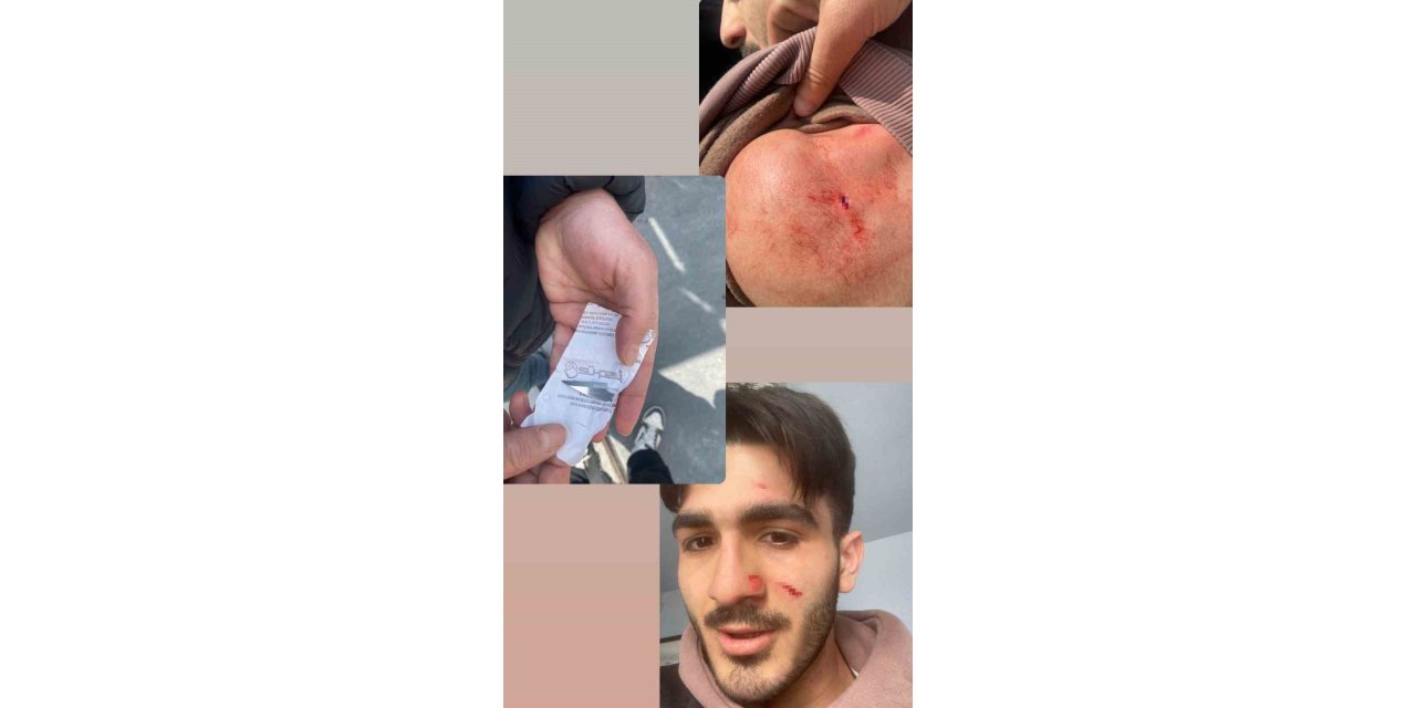 MİLLİ SPORCUYA ESKİ ANTRENÖRÜ SALDIRDI; VÜCUDUNDA ÇOK SAYIDA KESİK OLUŞTU