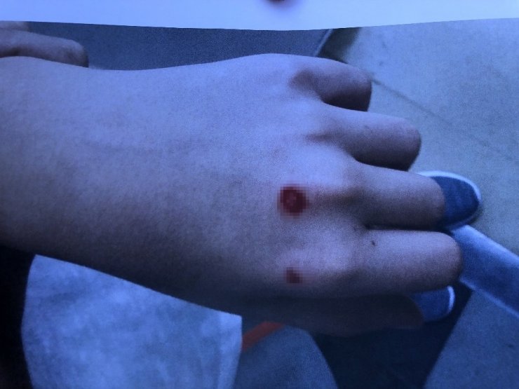 Vatandaşlar Köpek Saldırılarına Karşı Nöbette