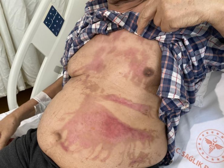 LAVABO AÇICILARDA PATLAMA RİSKİ: UZMANINDAN ‘ETİKET’ UYARISI