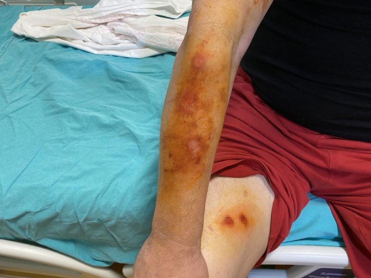 LAVABO AÇICILARDA PATLAMA RİSKİ: UZMANINDAN ‘ETİKET’ UYARISI