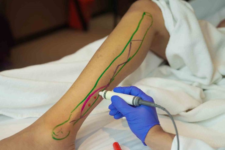 DOKU TRANSFERİYLE YARA ONARIMINDA YENİ DÖNEM