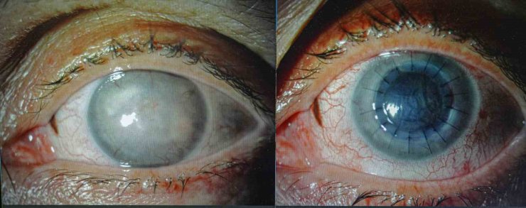 ‘GÖREMEZSİN’ DENİLEN LİBYALI KADIN TÜRKİYE’DE AYDINLIĞA KAVUŞTU