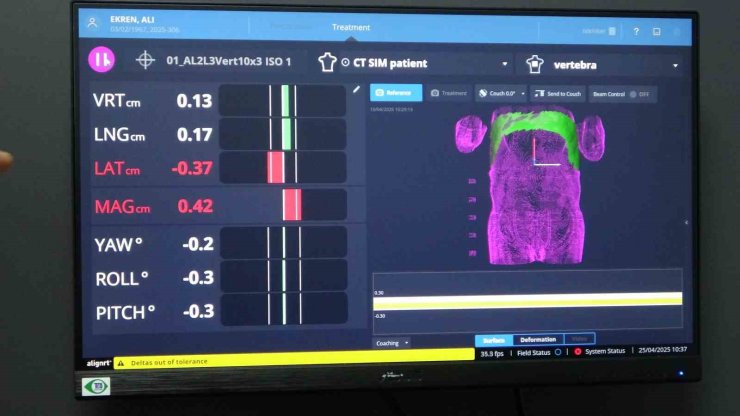 KANSER TEDAVİSİNDE ’YENİ NESİL RADYOTERAPİ’ DÖNEMİ BAŞLADI