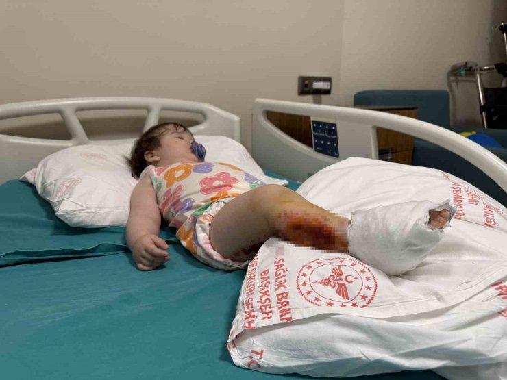 ÜZERİNE ÇAYDANLIK DEVRİLEN 1 YAŞINDAKİ BEBEK DEHŞETİ YAŞADI, VÜCUDUNUN YÜZDE 15’İ YANDI