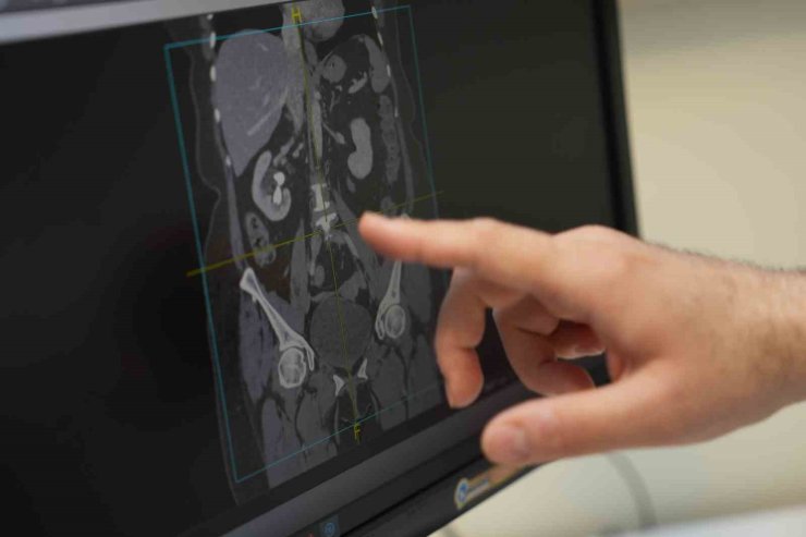 "ERKEK SAĞLIĞININ SIRRI SOFRADA: BESLENMEYLE CİNSEL GÜCÜ ARTIRIN"